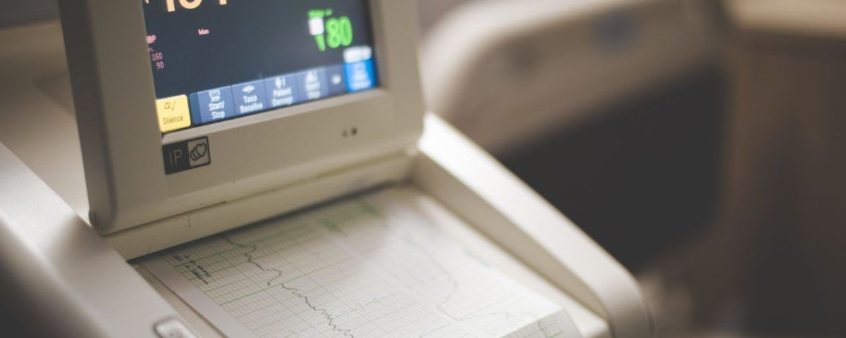 ekg