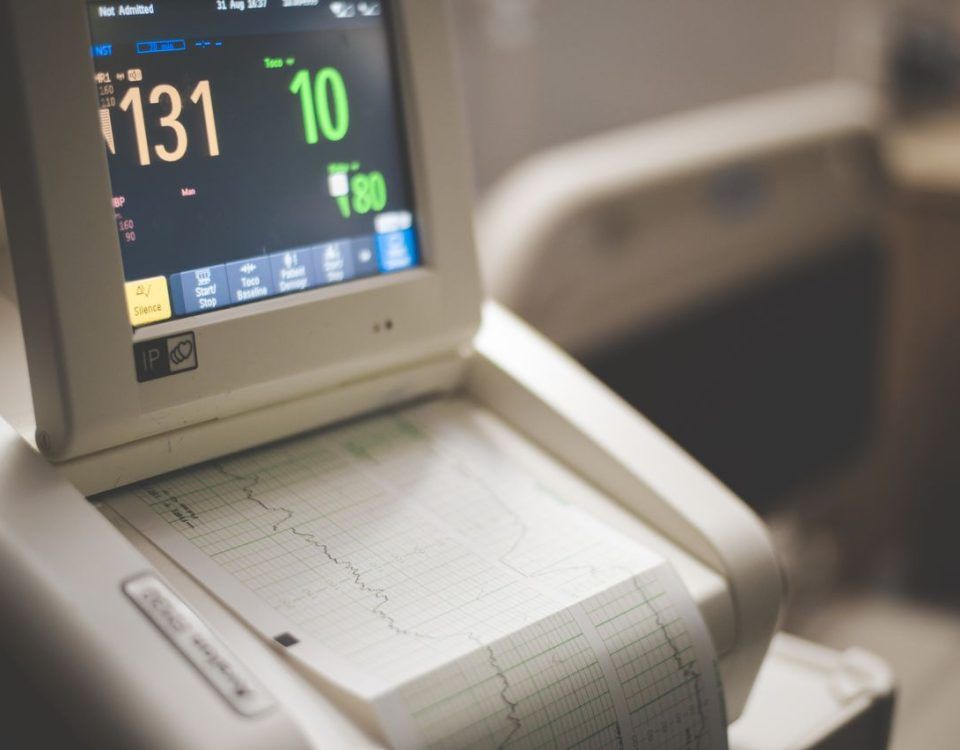 ekg